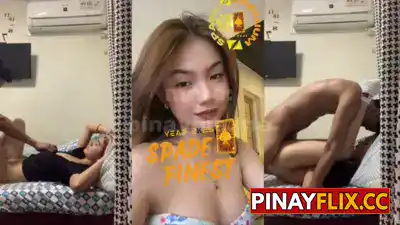 Di lang buto ang naunat pati bilat